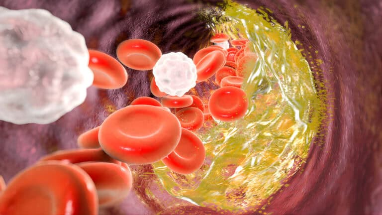 Gene Editing Therapy Cuts Dangerous Cholesterol Permanently | CRISPR Breakthrough 2025