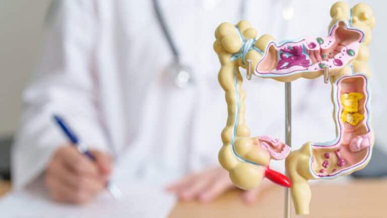 Colon Cancer Tops Cancer Deaths in Young Adults
