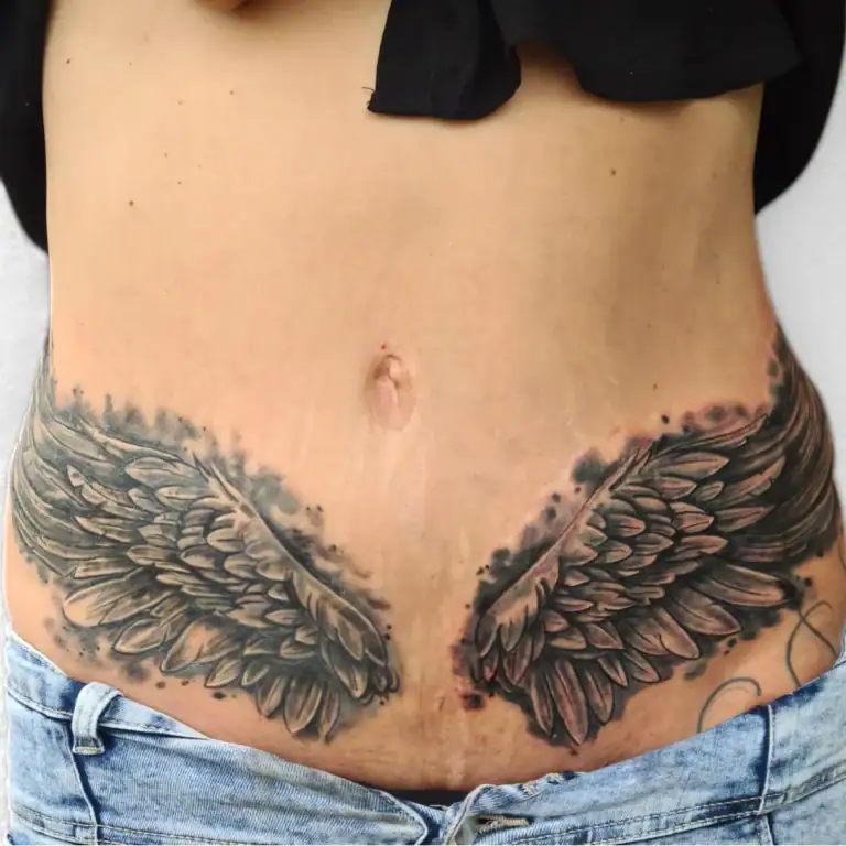 Narbentattoo in Widnau mit Engelsflügeln über OP-Narbe am Bauch im Tattoo Studio Widnau