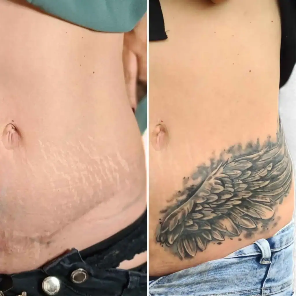 Vorher und Nachher bind von einer Narbe am Bauch. die mit einem Engelsflügen im Black and Grey Stil verdeckt wurde