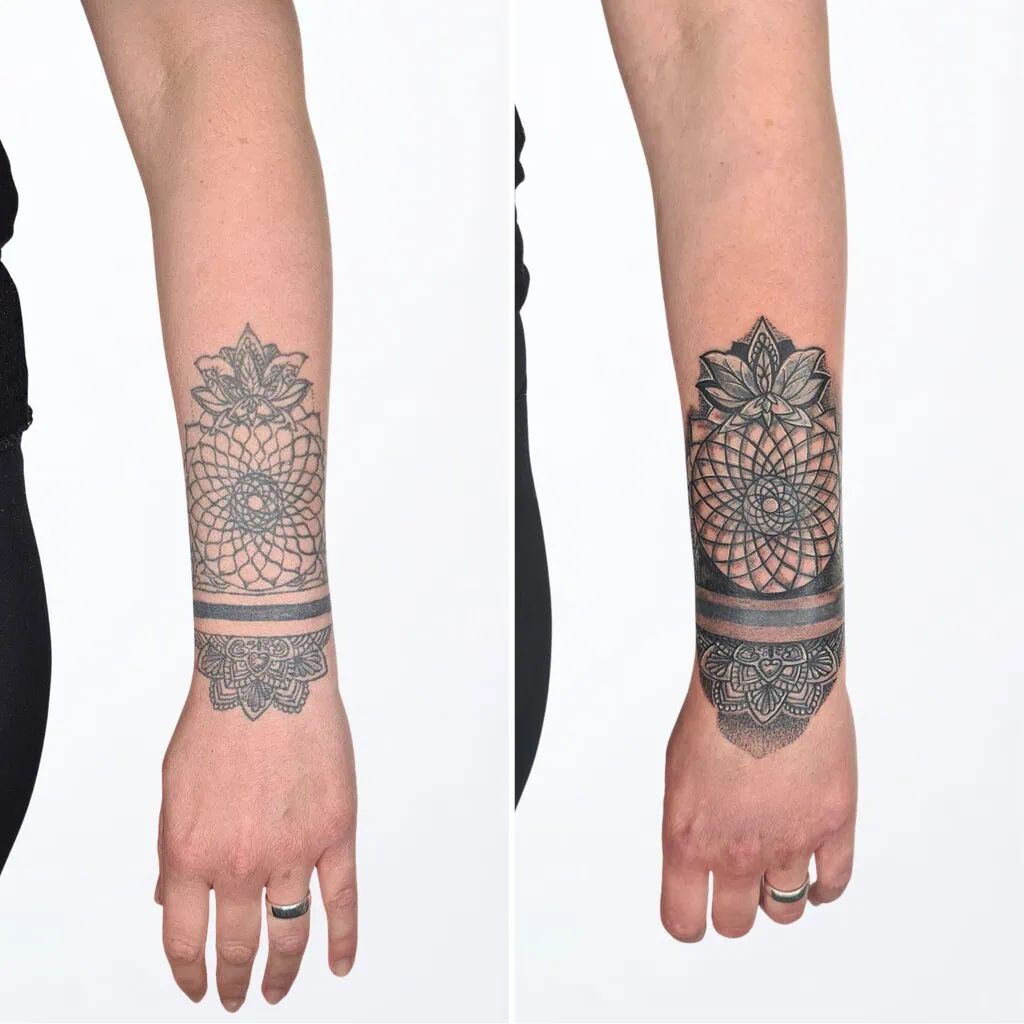 Vorher-Nachher Vergleich eines Mandala Tattoos – Linien und Schattierungen durch Touch-Up Tattoo in Widnau aufgefrischt.