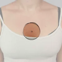 Ein eleganter Dermal Anchor im Dekolleté, kunstvoll platziert für subtile Eleganz, betont durch einen zarten Silberschmuck.