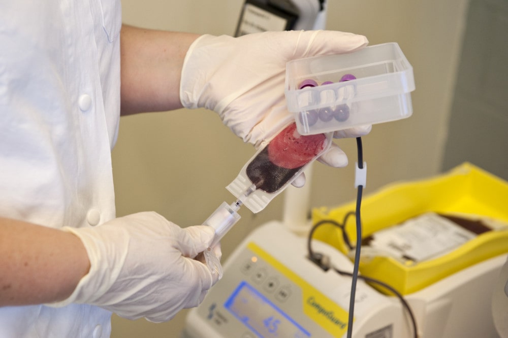 donazione avis bologna