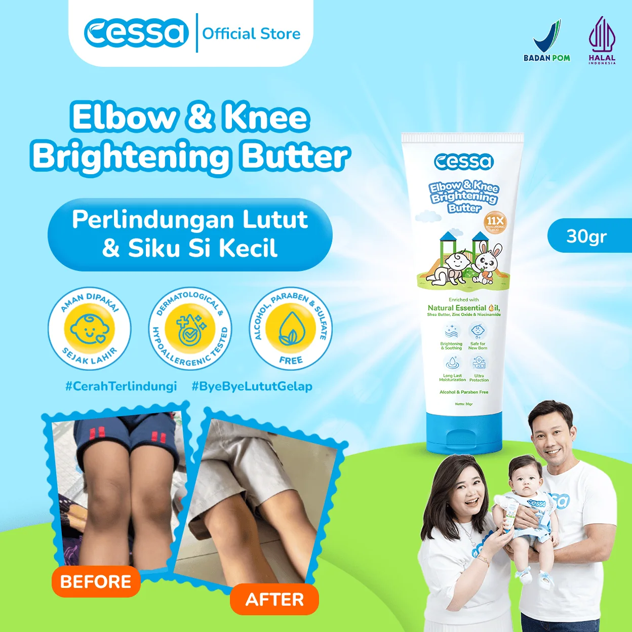 Cessa Elbow & Knee Brightening Butter - Efektif Mencerahkan Dan Menghidrasi Kulit