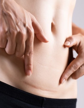 Img-Srv-Cirugia-Reconstructiva