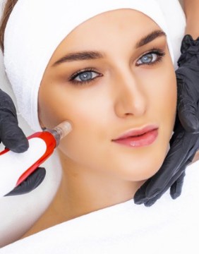 Img-Srv-Peeling-Dermoabrasión