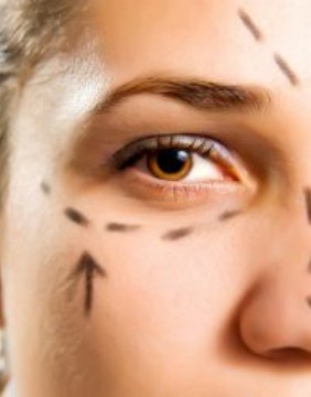 Img-Srv-Blefaroplastica