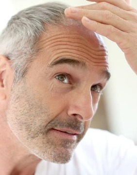 Img-Srv-Implante-Capilar