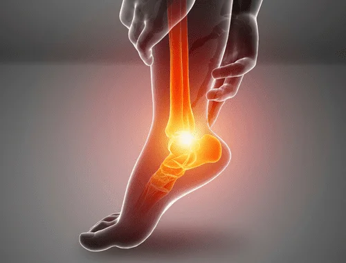 Rotational Leg Length Discrepancy