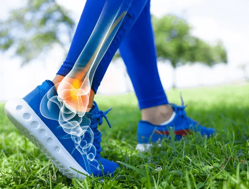 Person running with custom orthopedic shoe lift modifications