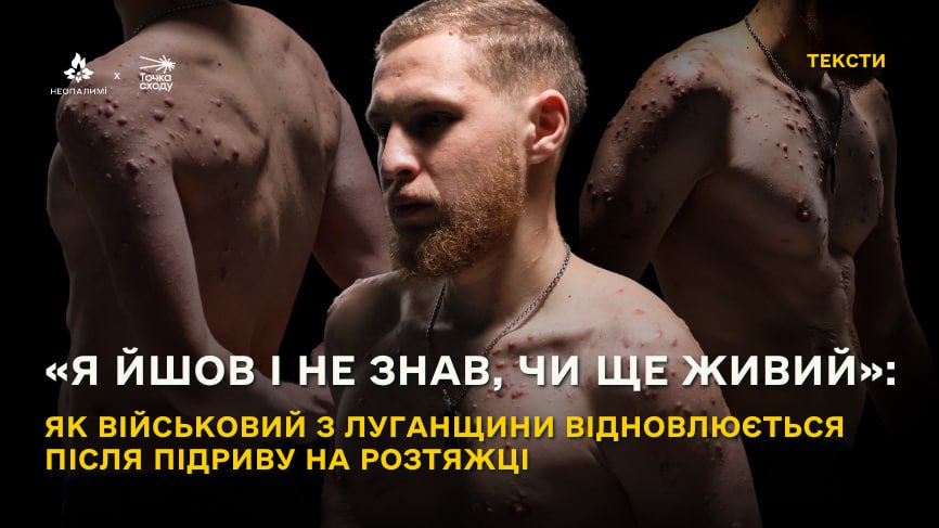 Стаття: «Я йшов і не знав, чи ще живий»: як військовий з Луганщини відновлюється після підриву на розтяжці