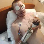 Зображення посту: «Життя триває і треба встигнути його прожити»: історія Івана Сороки, який втратив зір на війні
