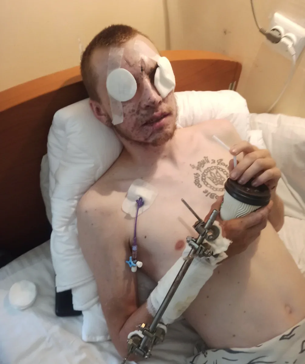 Зображення посту: «Життя триває і треба встигнути його прожити»: історія Івана Сороки, який втратив зір на війні