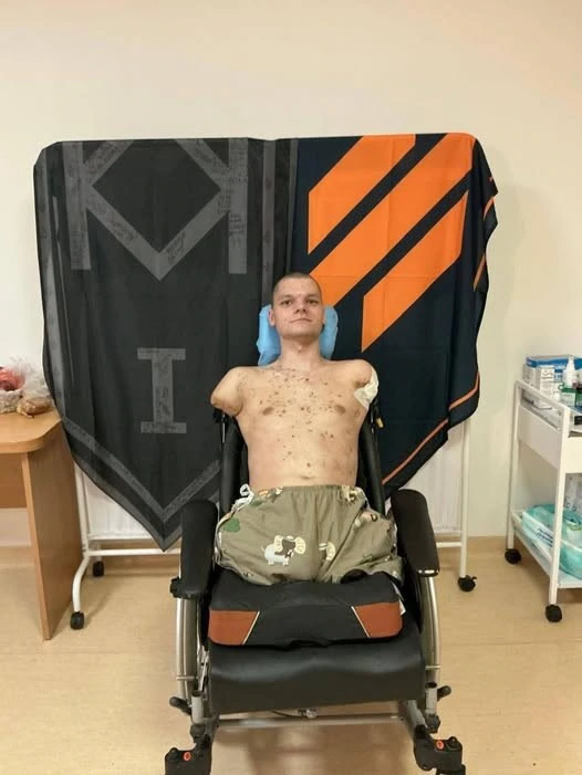 Зображення посту: Ветерану без кінцівок не дали картку для отримання виплат: у «ПриватБанку» вибачились