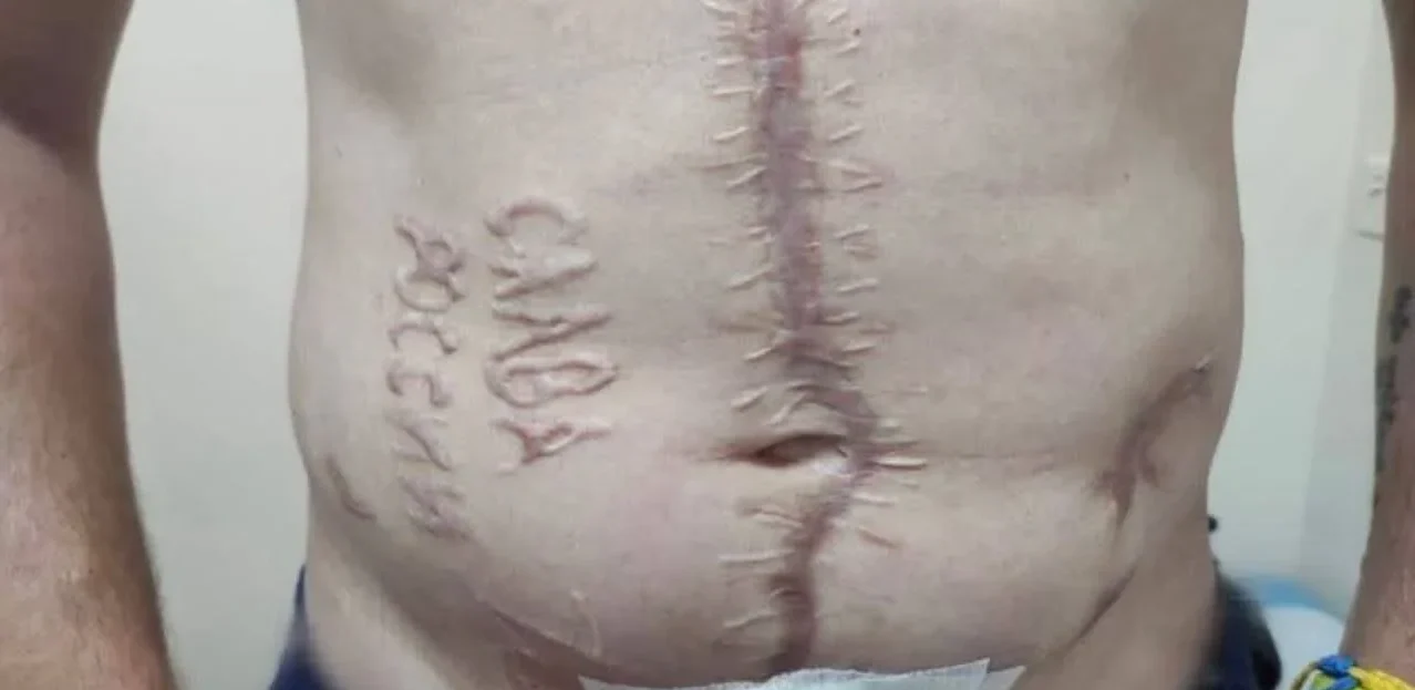 Зображення посту: «Слава Росії» на тілі українського військового: стало відомо, хто з лікарів міг випалити напис