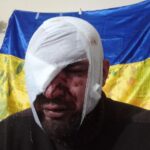 Зображення посту: Повернення усмішки: як в Україні діє стоматологічна реабілітація для ветеранів