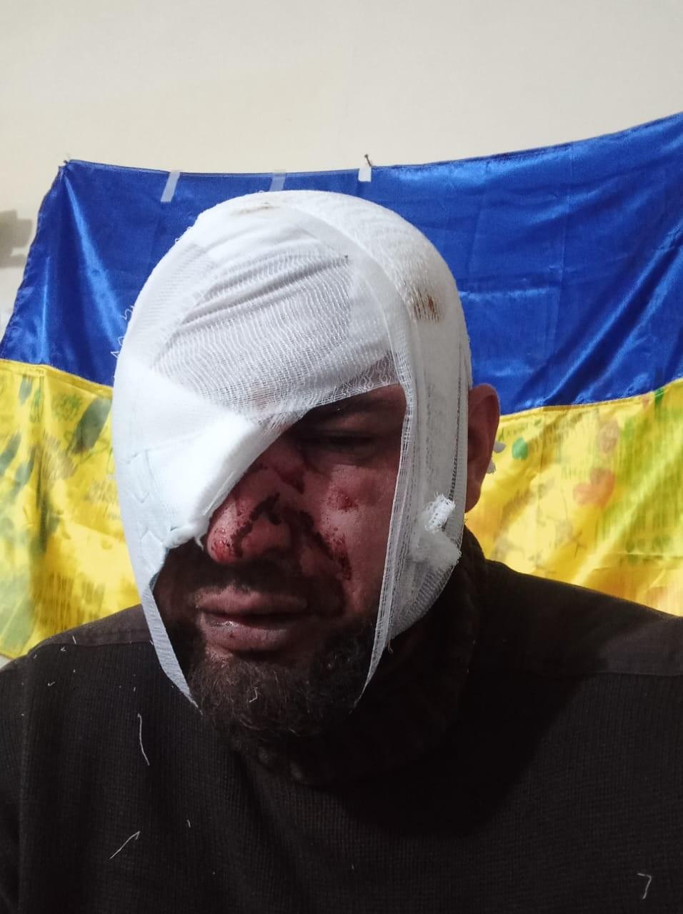 Зображення посту: Повернення усмішки: як в Україні діє стоматологічна реабілітація для ветеранів