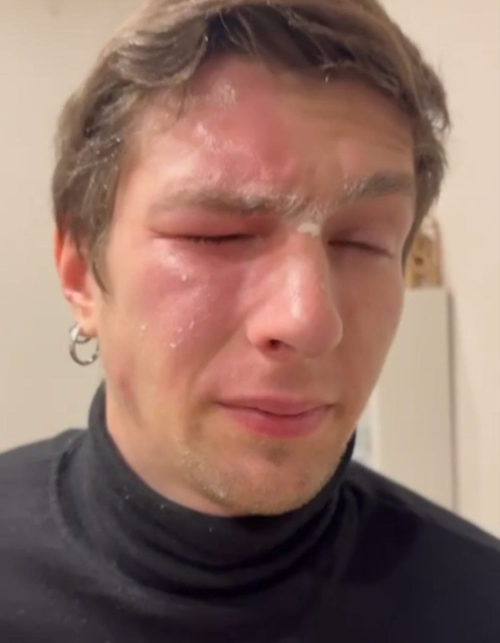 Зображення посту: У Львові захиснику Маріуполя забризкали очі перцевим балончиком: що відомо про конфлікт