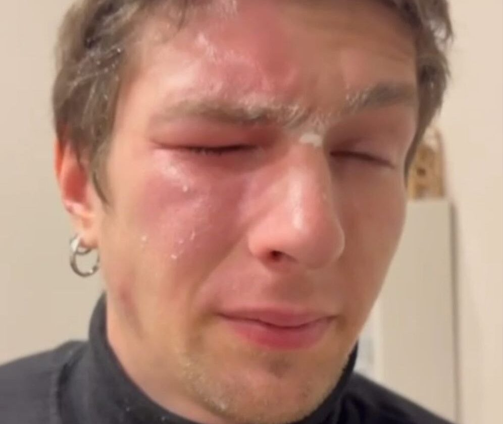 Стаття: У Львові захиснику Маріуполя забризкали очі перцевим балончиком: що відомо про конфлікт