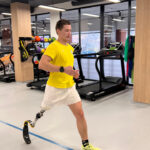 Зображення посту: Тисяча українців з ампутаціями зможуть безоплатно отримати протези від міжнародної програми