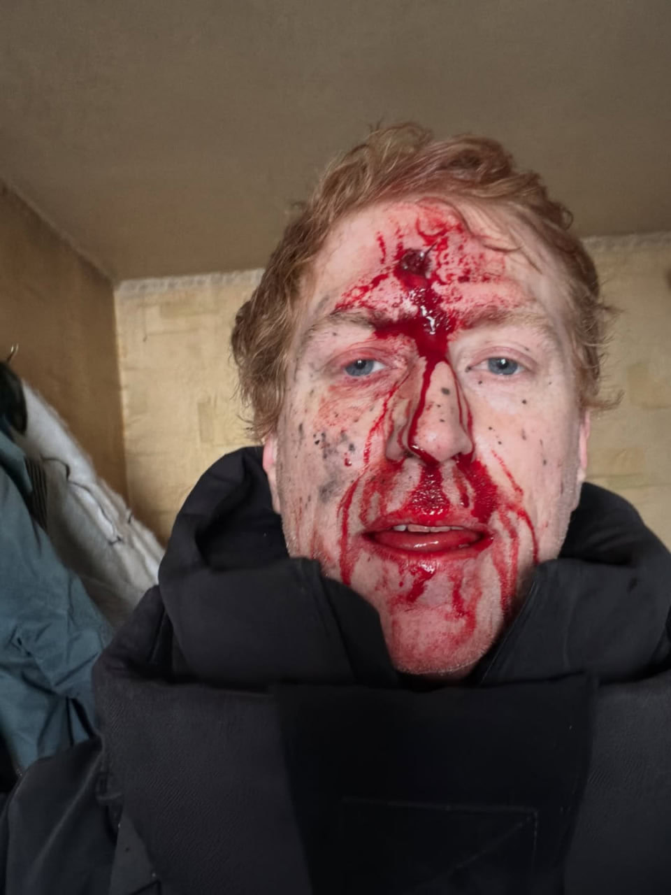 Стаття: Волонтер Денис Христов потрапив під обстріл на Харківщині