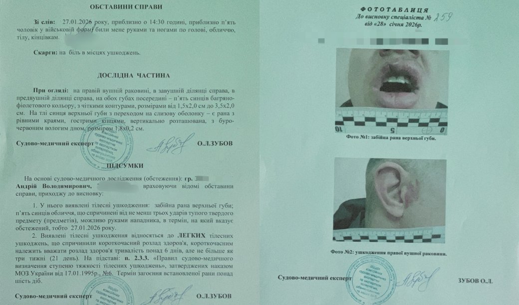 Зображення посту: У Дніпрі ветеран заявив про викрадення і побиття працівниками ТЦК