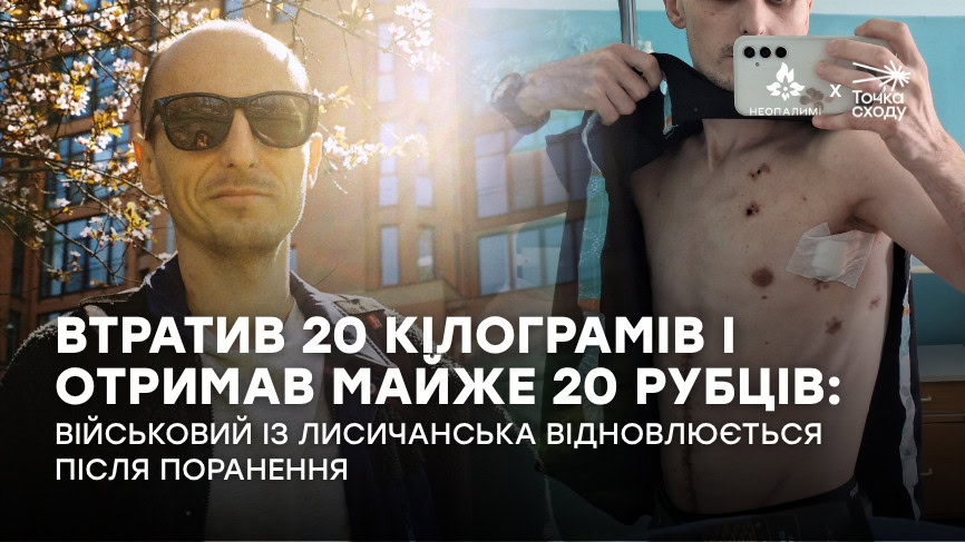 Стаття: Втратив 20 кілограмів і отримав майже 20 рубців: військовий із Лисичанська відновлюється після поранення