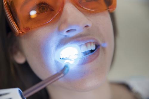 blanqueamiento_dental_img