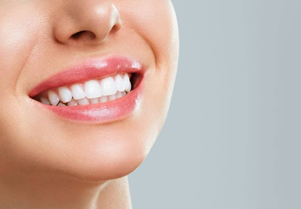 Come avere denti bianchi dal dentista