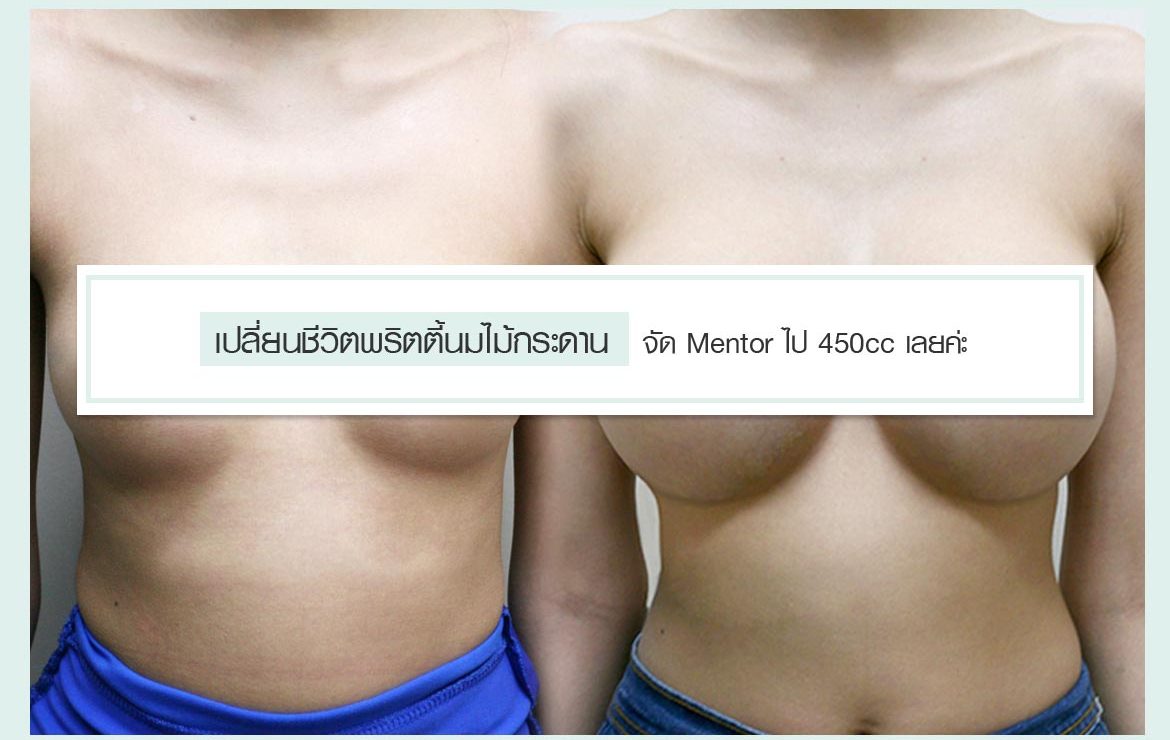 เปลี่ยนชีวิตพริตตี้นมไม้กระดาน จัดMentor ไป 450 cc เลยค่ะ