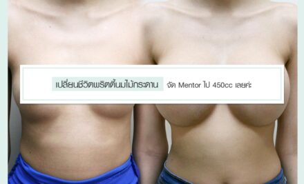 เปลี่ยนชีวิตพริตตี้นมไม้กระดาน จัดMentor ไป 450 cc เลยค่ะ
