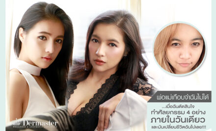 พ่อแม่เกือบจำฉันไม่ได้ …เมื่อฉันตัดสินใจทำศัลยกรรม 4 อย่าง ภายในวันเดียว และมันเปลี่ยนชีวิตฉันไปเลย!!!