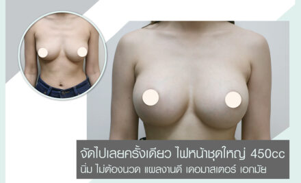 จัดไปเลยครั้งเดียว ไฟหน้าชุดใหญ่ 450cc นิ่ม ไม่ต้องนวด แผลงานดี เดอมาสเตอร์ เอกมัย