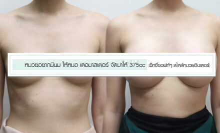 หมวยอยากมีนม ให้หมอ เดอมาสเตอร์ จัดมาให้ 375cc เซ็กซี่ซอฟท์ๆ สไตล์หมวยอินเตอร์