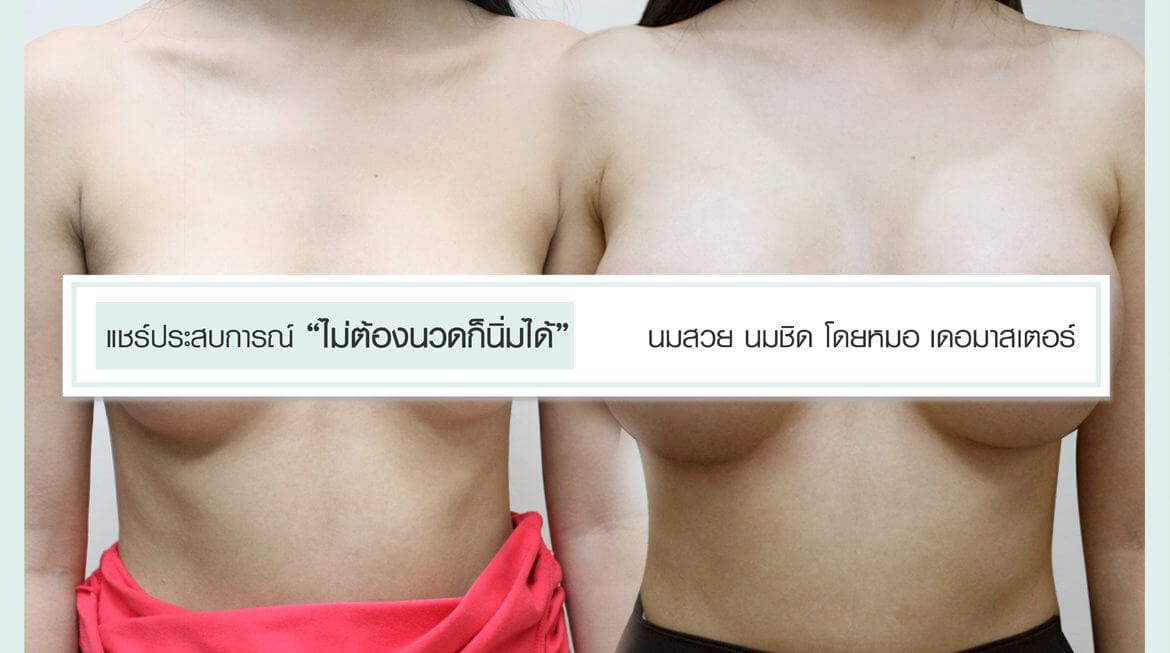 แชร์ประสบการณ์ “ไม่ต้องนวดก็นิ่มได้” นมสวย นมชิด โดยหมอที่ เดอมาสเตอร์