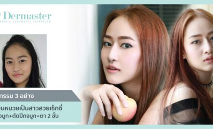 ศัลยกรรม 3 อย่าง เปลี่ยนเด็กหน้ามึน เป็นเด็กสวยหน้าใส วัยรุ่นสยาม ซีรีย์ : เสริมจมูก+ตัดปีกจมูก+ตา 2 ชั้น