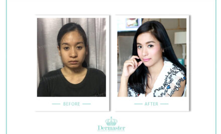 “ไม่สวย อย่าท้อ ….เดินหน้าหาหมอซิค่ะ” Make Over เปลี่ยนหน้าบ้านๆ ให้เป็นหน้าคุณหนูออกงานก็ได้”