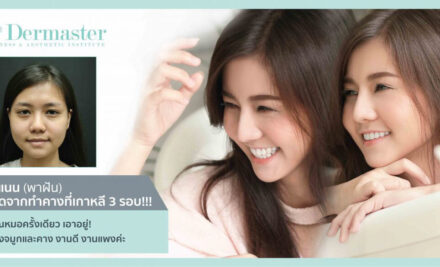 กว่าจะสวยขนาดนี้ เคยผ่านประสบการณ์ชีวิตพังเพราะศัลยกรรมเกาหลีมาแล้ว! “ขอบคุณ คุณหมอ Dermaster สำหรับการแก้หน้าพังๆ ให้กลับมาสวยได้อีกครั้ง”