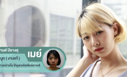 แก้จมูก ทรงสวยเกาหลี ที่ Dermaster เอกมัย “ขนาดงานแก้ ยังไม่ช้ำ รับรองคุณทำที่นี่ ก็ไม่ช้ำเหมือนกันค่ะ”