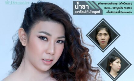 หมวยขอจมูกโด่ง ทรงสวย ไม่โป๊ะ ครั้งเดียวจบที่ Dermaster