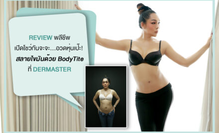 รีวิวพลีชีพ เปิดโชว์กันจะจะ …อวดหุ่นเป๊ะ สลายไขมันด้วย BodyTite ที่เดอมาสเตอร์