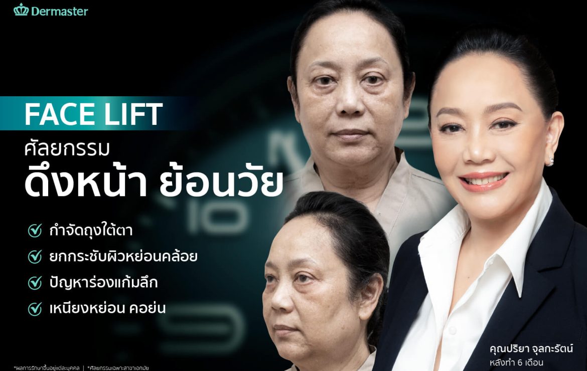 รีวิว – Face Lift ศัลยกรรมดึงหน้า ย้อนวัย (คุณน้อง ปริยา จุลกะรัตน์)