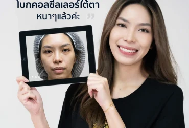 ศัลยกรรมถุงใต้ตา