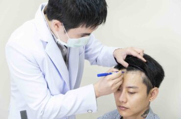 ถาม – ตอบ ปัญหาการปลูกผม เทคนิค FUE