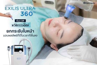 Exilis Ultra 360 – Facial