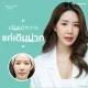 รีวิว – Filler ปากสายเกาหลี โดยคุณเจย์ Influencer