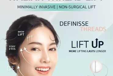 Definisse : Italian Threads Lift