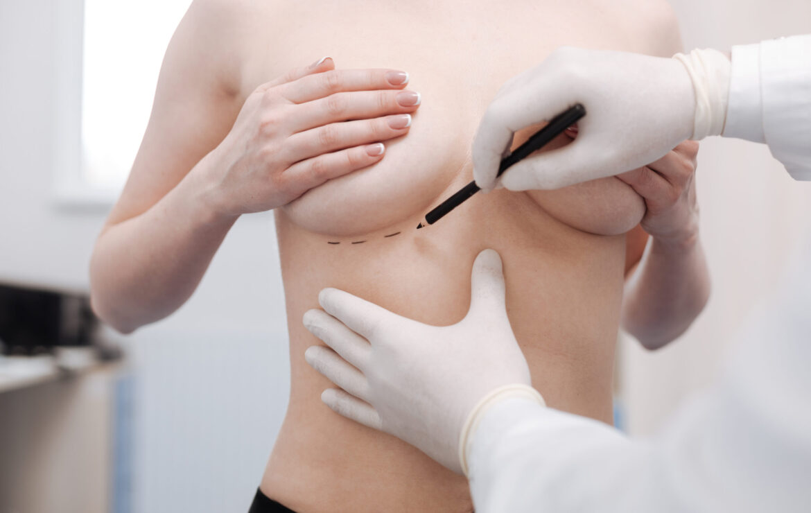 เลือกตำแหน่งผ่าตัดเสริมหน้าอก