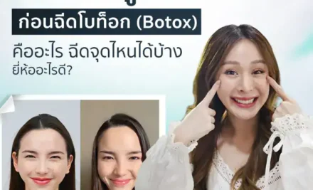 เรื่องควรรู้ก่อนฉีดโบท็อก (Botox) คืออะไร ฉีดจุดไหนได้บ้าง ยี่ห้ออะไรดี?