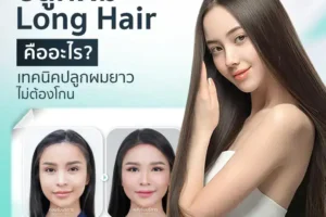 ปลูกผม Long Hair คืออะไร? เทคนิคปลูกผมยาว ไม่ต้องโกน